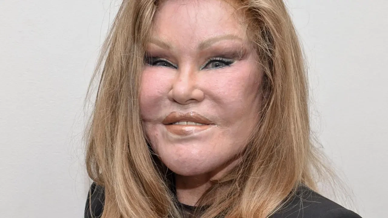 Estetik operasyonlarıyla tanınan Kedi Kadın Jocelyn Wildenstein hayatını kaybetti 1