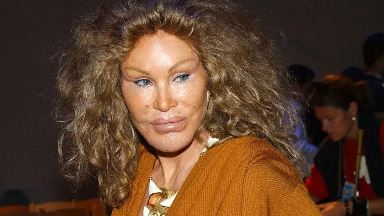 Estetik operasyonlarıyla tanınan Kedi Kadın Jocelyn Wildenstein hayatını kaybetti 6