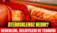 Ateroskleroz Nedir? Nedenleri, Belirtileri ve Tedavisi